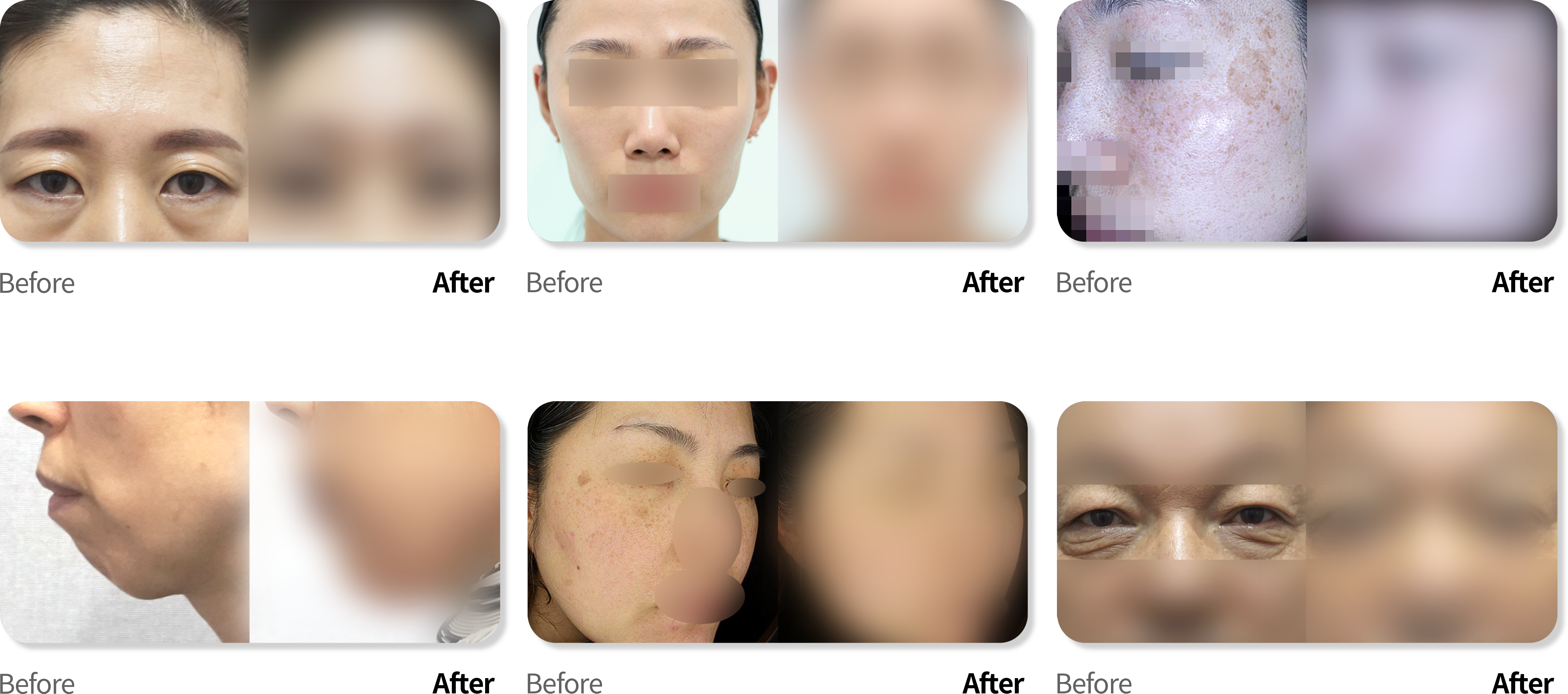 대전점 케이스 전후사진